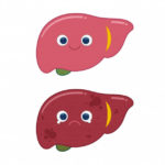 silymarin health benefits