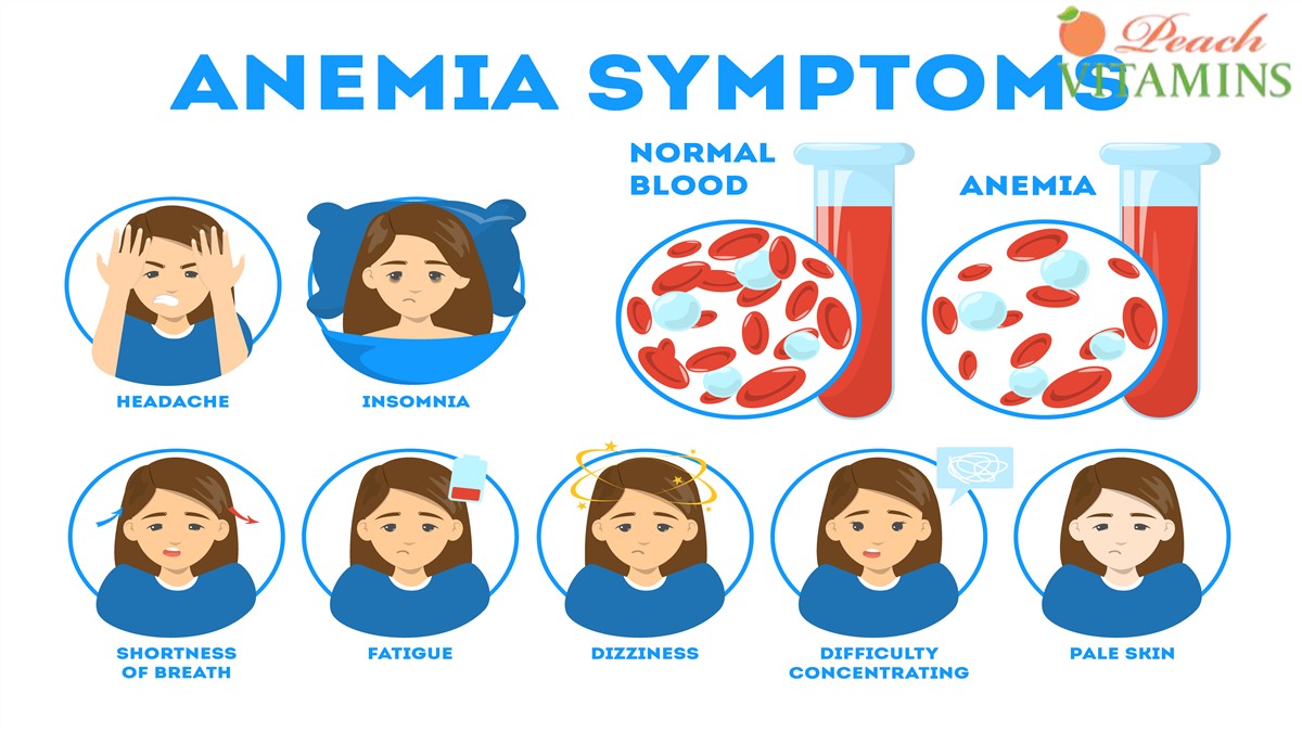 Iron Deficiency Anemia Leg Pain Causes Of Iron Deficiency Anemia In 
