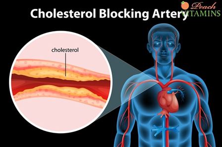 Is Alcohol Bad For Cholesterol