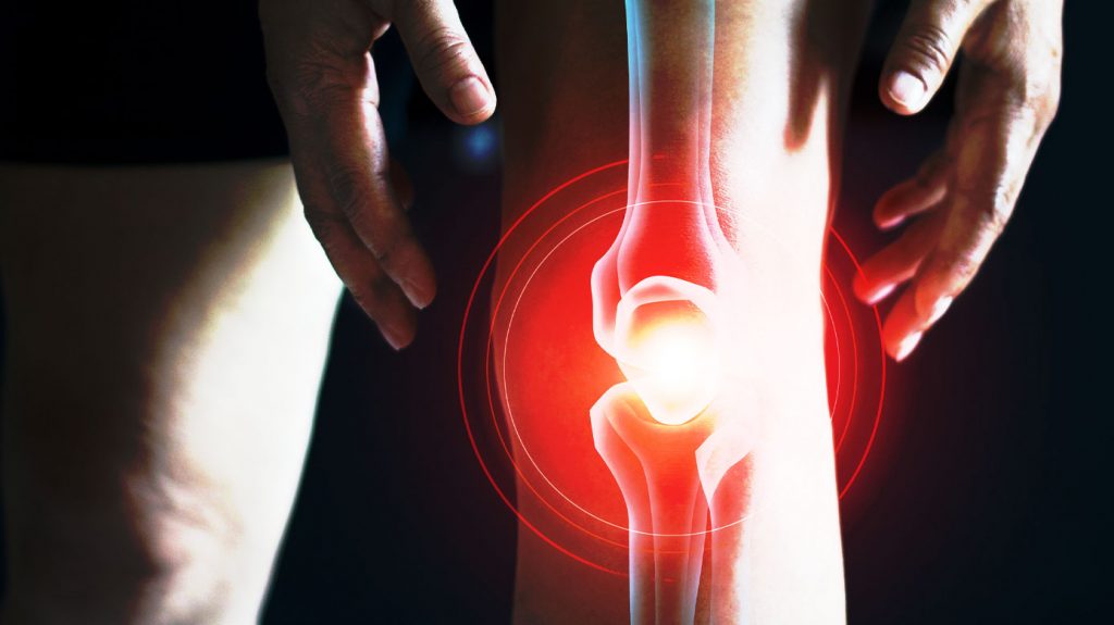 Ayurvedic Medicine For Osteoarthritis Of Knee – Osteoarthritis Treatment for Knee Joint Pain
